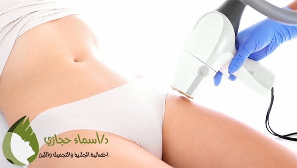أضرار إزالة الشعر بالليزر