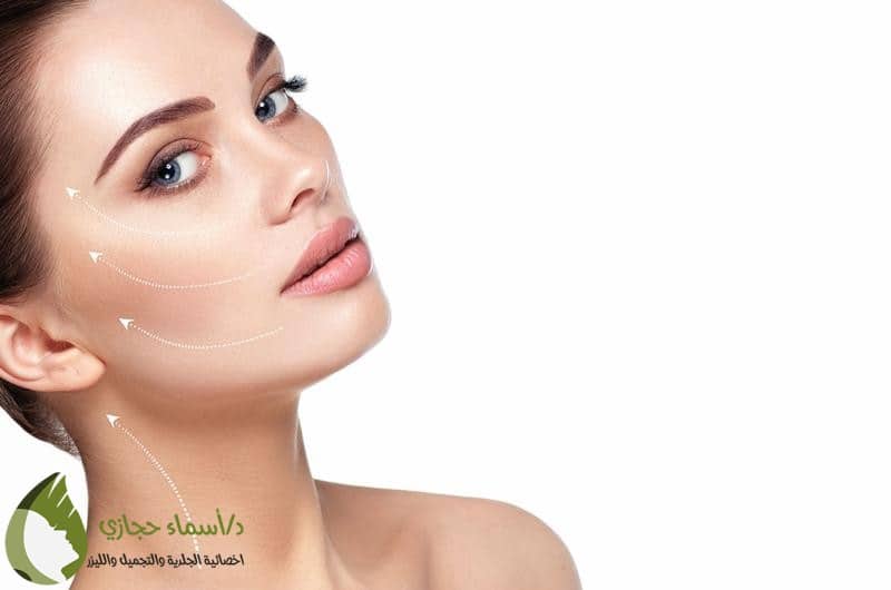 عملية شد الوجه بالخيوط قبل وبعد بالصور و الفيديو 2024