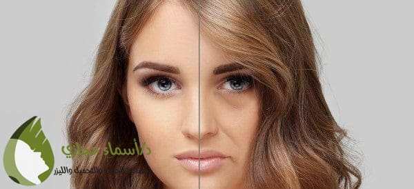 أفضل تقنية لنضارة البشرة