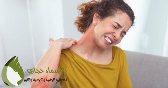 علاج الإكزيما