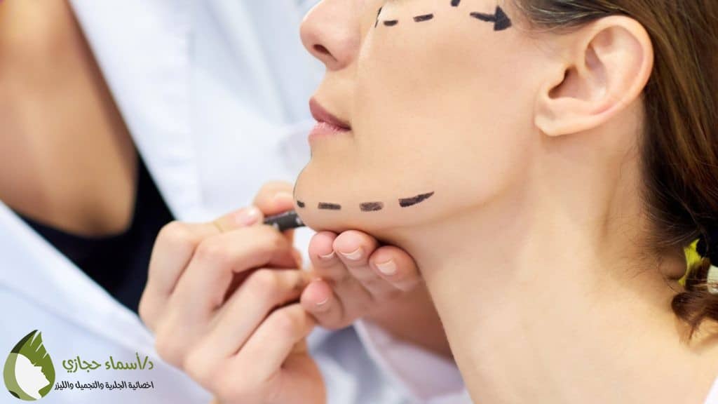 خيوط التجميل | الموقع الالكتروني للدكتورة اسماء حجازي خيوط التجميل لشد الوجه