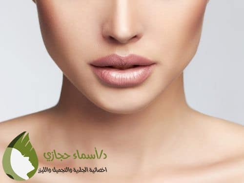 فيلر تحديد الفك | الموقع الالكتروني للدكتورة اسماء حجازي فيلر تكساس لتحديد الفك