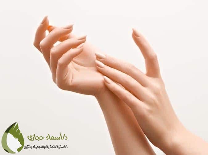 حقن الدهون الذاتية لليدين