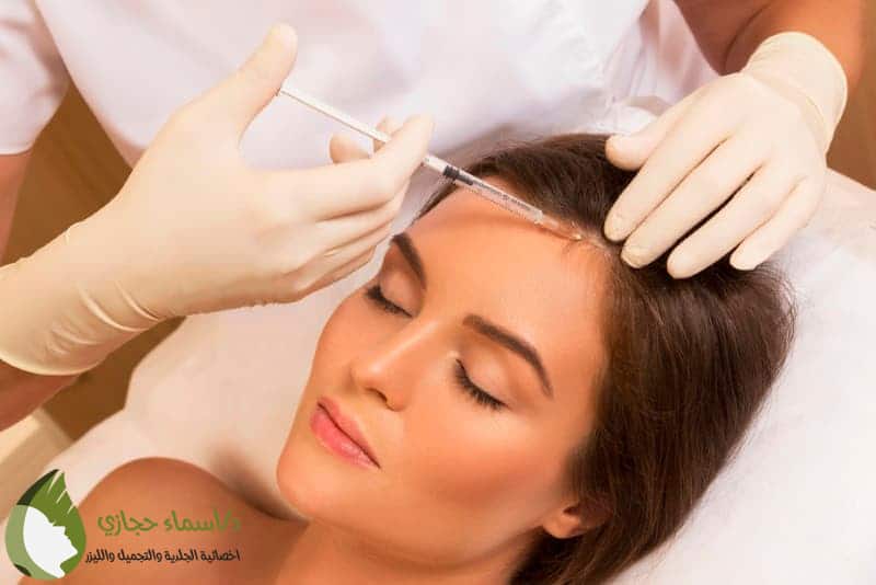أضرار حقن البلازما للشعر