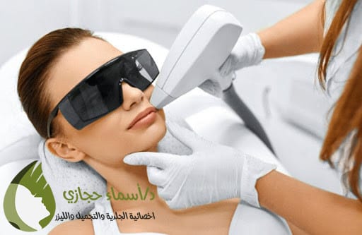 إزالة الشعر بالليزر في جدة