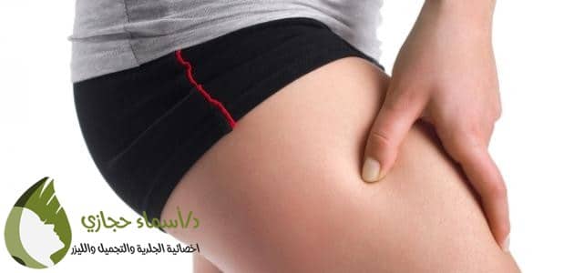Monawa3At 26 1464784323 | الموقع الالكتروني للدكتورة اسماء حجازي علاج السمنة الموضعية في الارداف