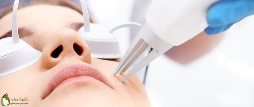 علاج الندبات والحفر