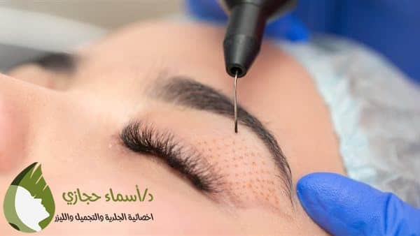 تقنية البلازماج