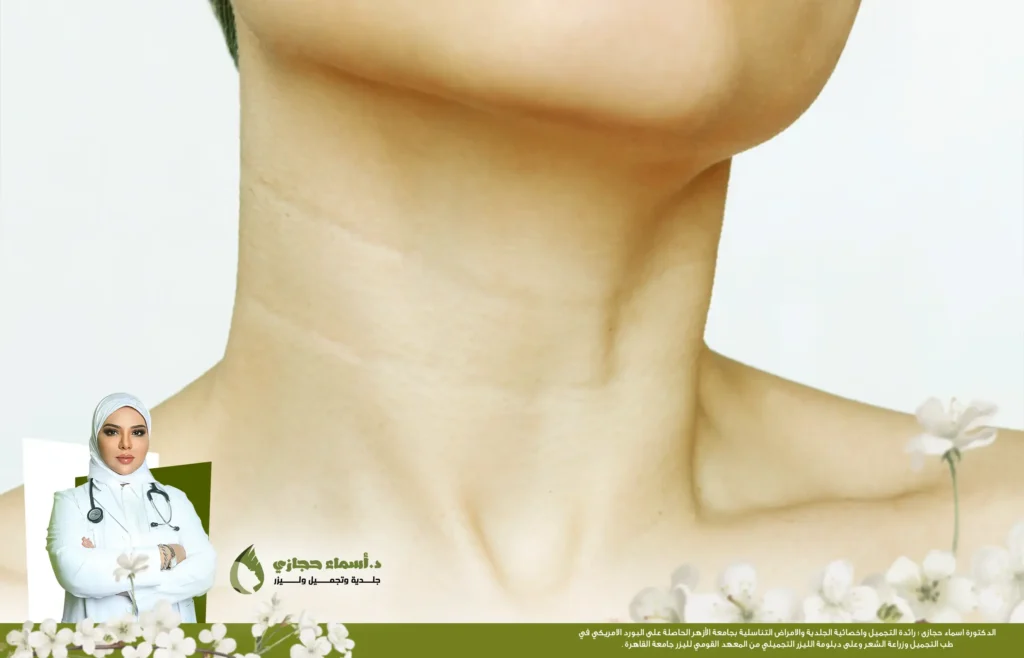 خطوط الرقبة