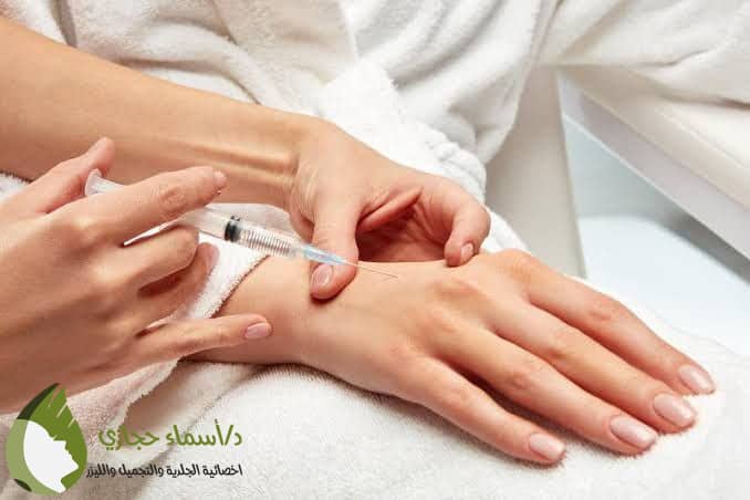علاج تجاعيد اليدين