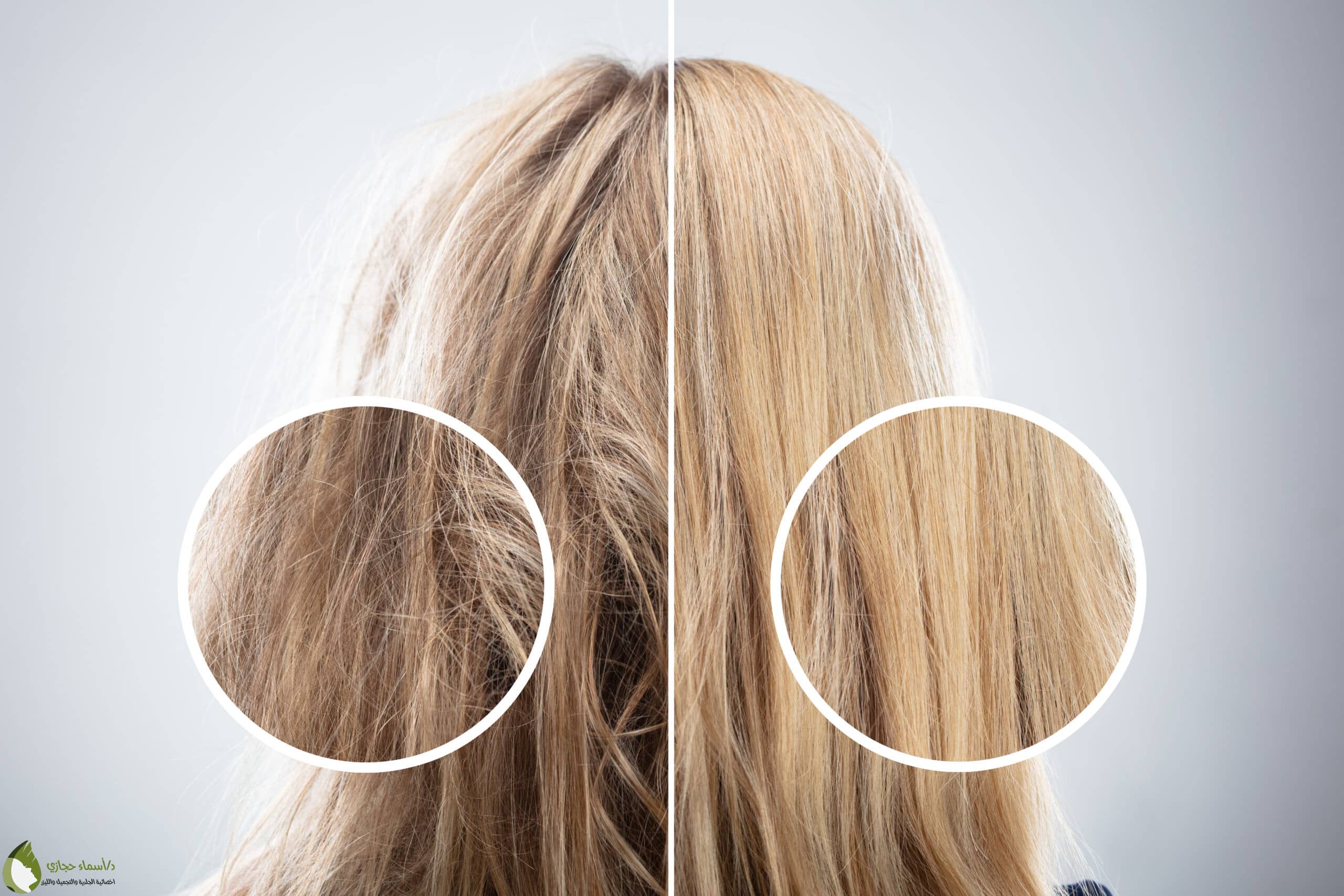 Hair Care 11 Scaled | الموقع الالكتروني للدكتورة اسماء حجازي العنايه بالشعر