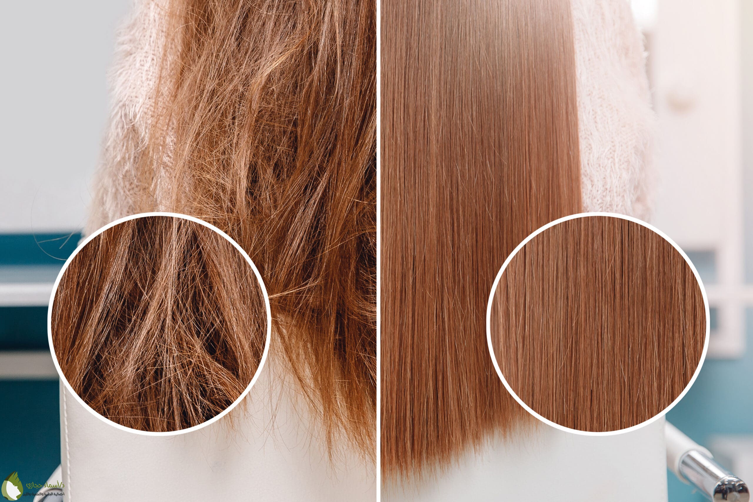 Hair Care 13 Scaled | الموقع الالكتروني للدكتورة اسماء حجازي العنايه بالشعر