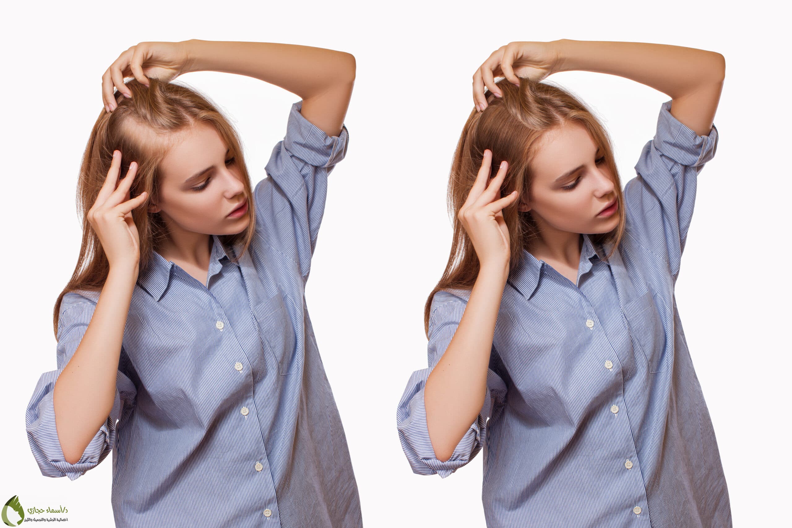 Hair Care 6 Scaled | الموقع الالكتروني للدكتورة اسماء حجازي العنايه بالشعر