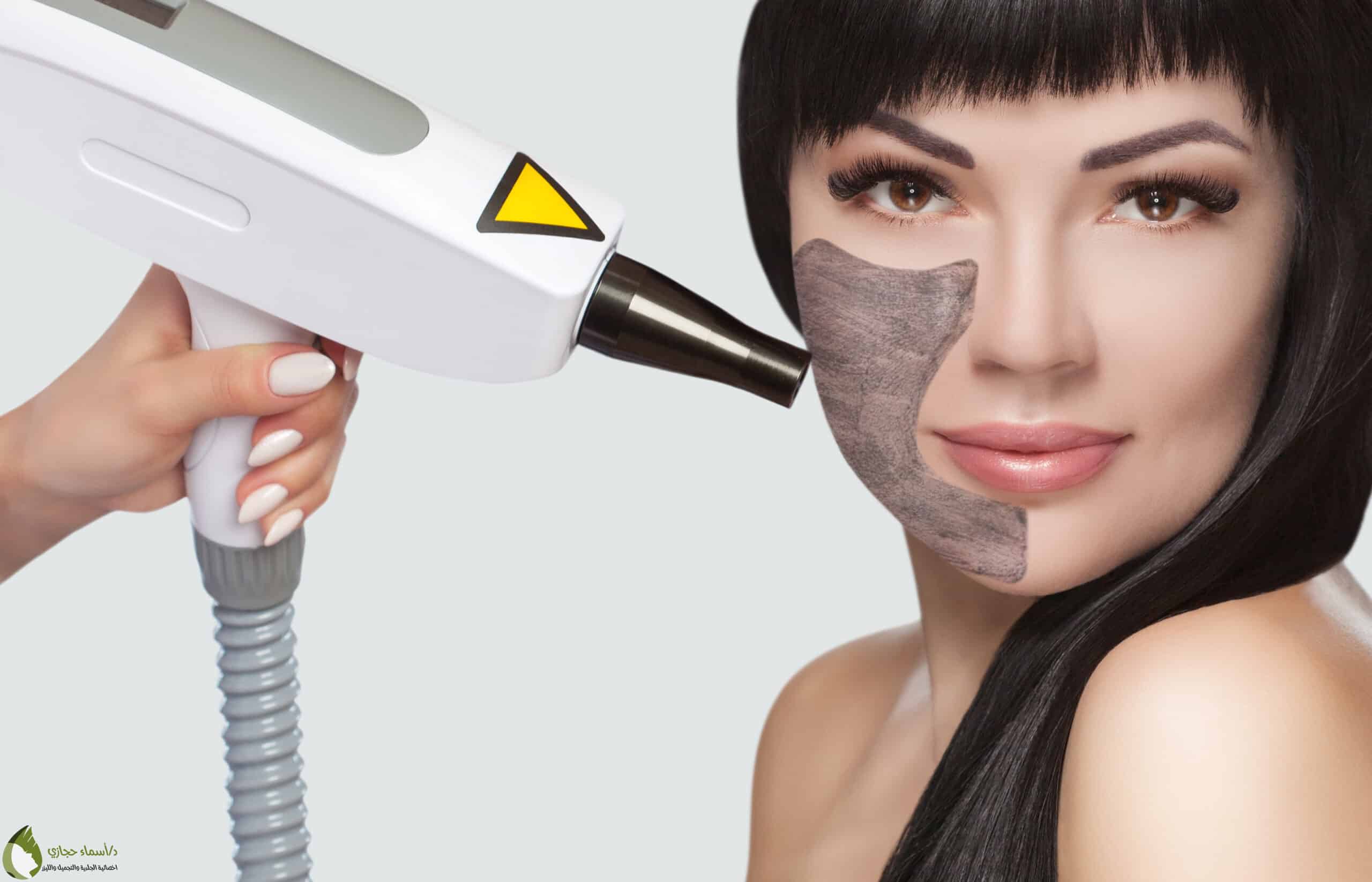 Laser Services 13 Scaled | الموقع الالكتروني للدكتورة اسماء حجازي خدمات الليزر