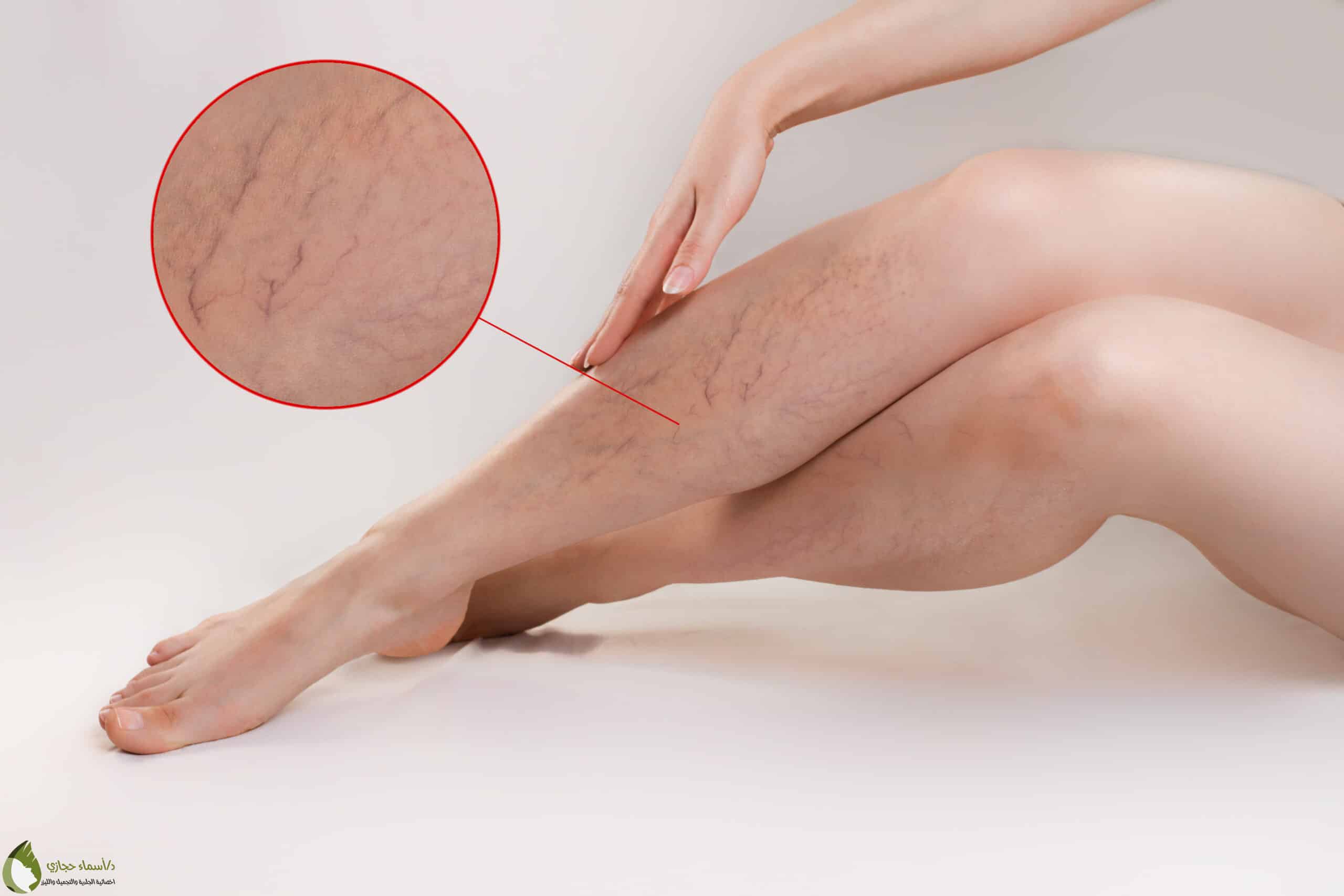 Laser Services 14 Scaled | الموقع الالكتروني للدكتورة اسماء حجازي خدمات الليزر