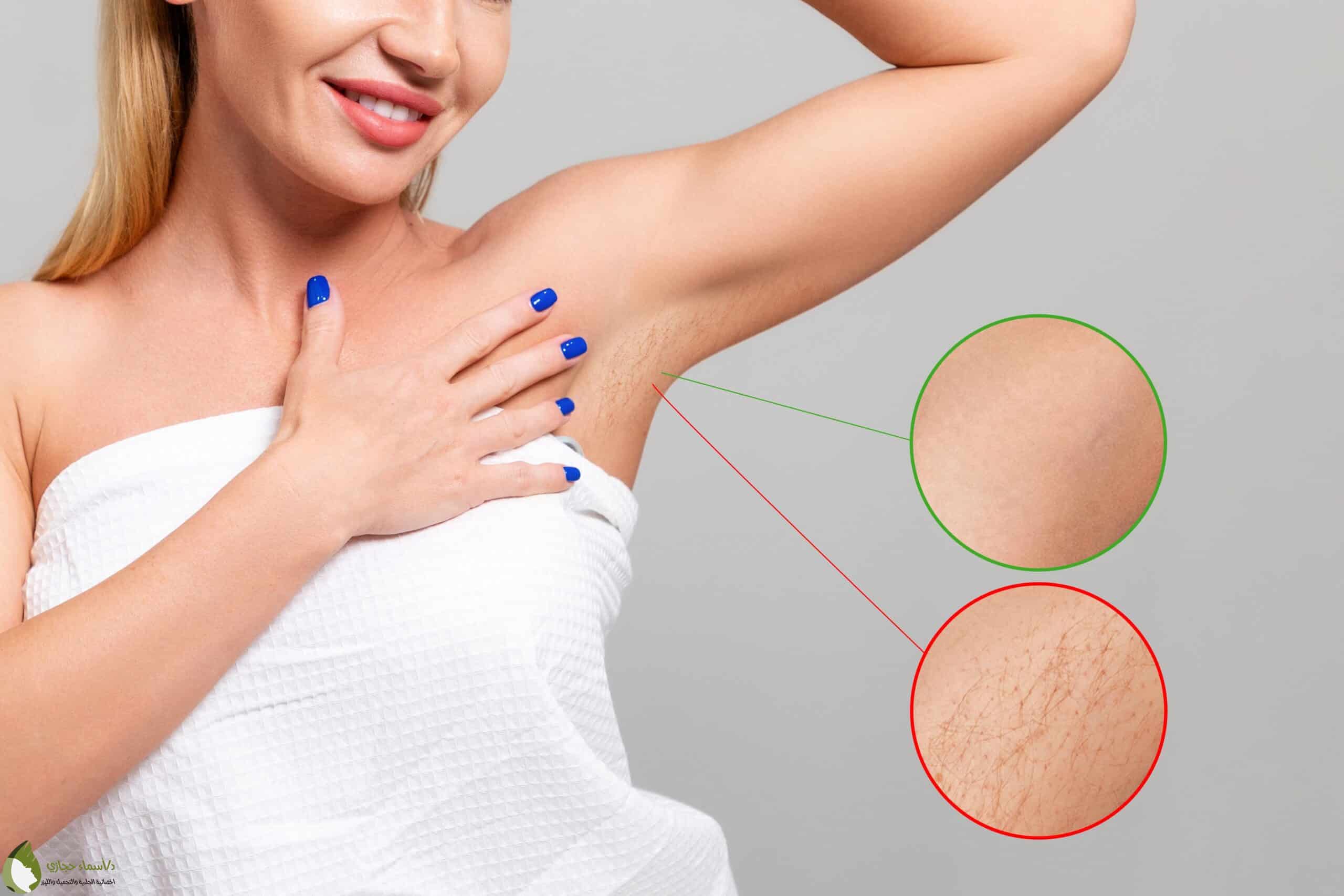 Laser Services 26 Scaled | الموقع الالكتروني للدكتورة اسماء حجازي خدمات الليزر