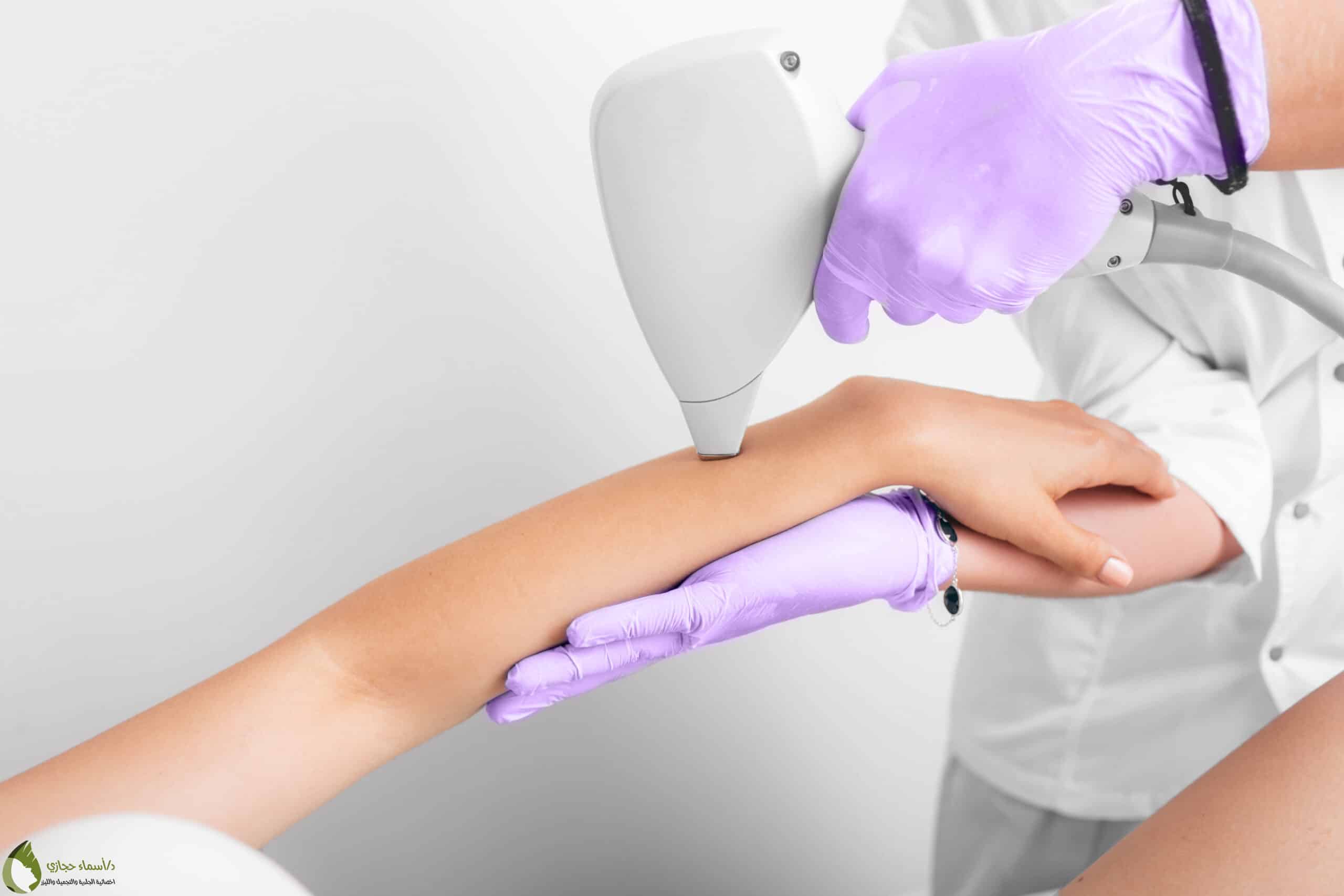 Laser Services 8 Scaled | الموقع الالكتروني للدكتورة اسماء حجازي خدمات الليزر