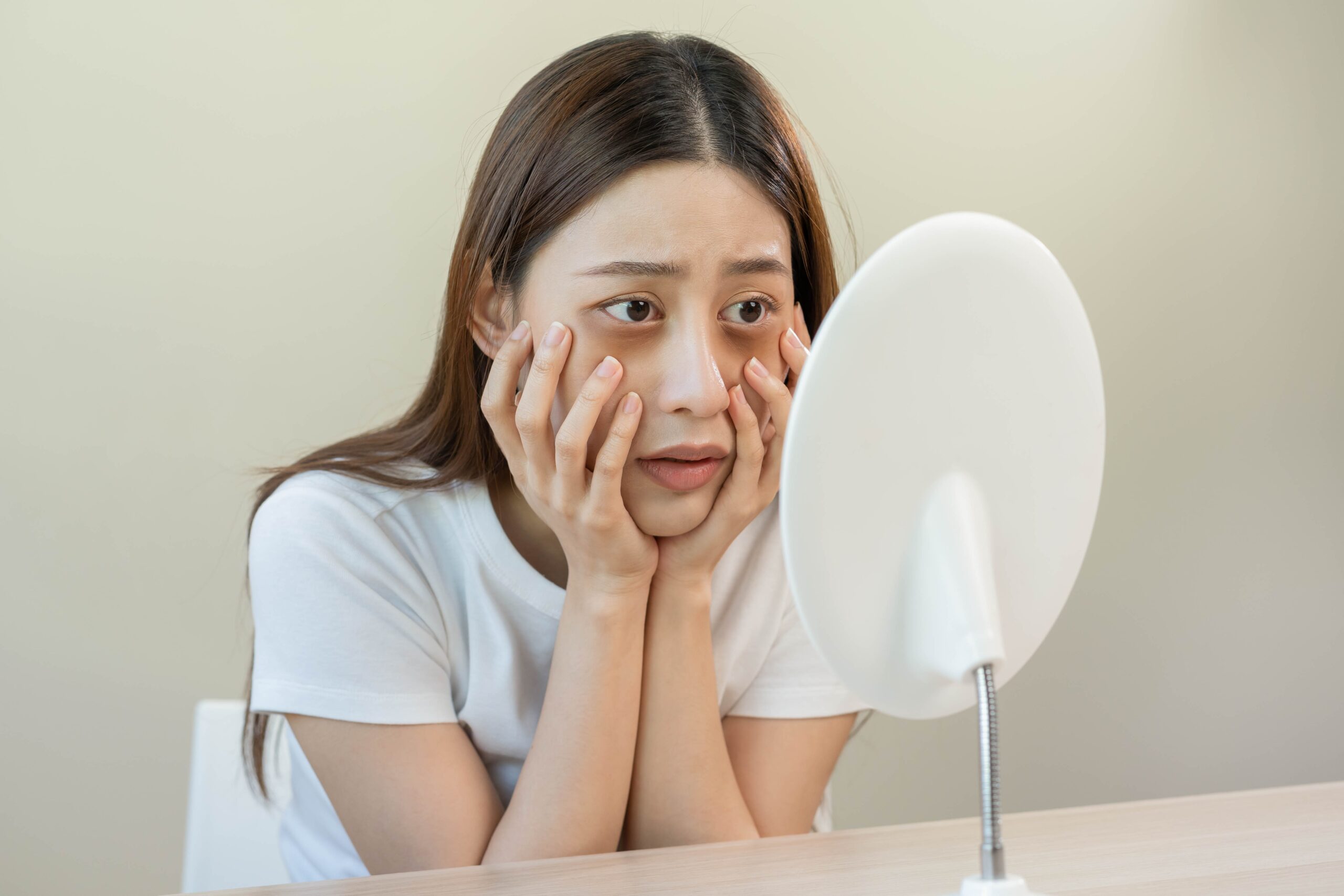 علاج الهالات السوداء تحت العين