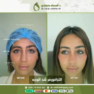 الترافورمر